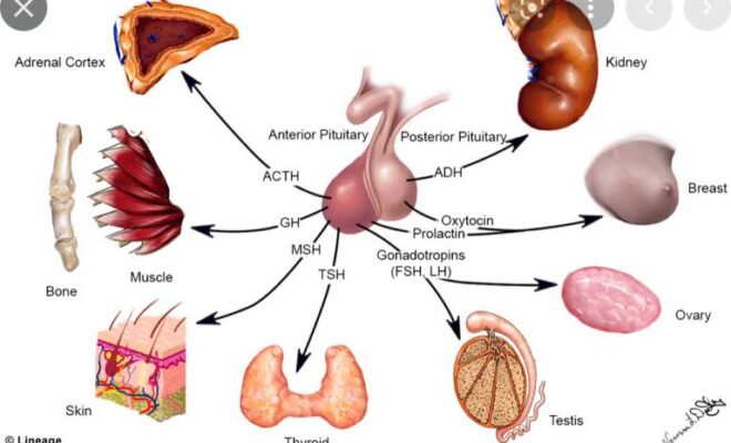 Tumor de Hipófise